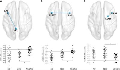 Altered functional connectivity and regional brain activity in a triple-network model in minimally conscious state and vegetative-state/unresponsive wakefulness syndrome patients: A resting-state functional magnetic resonance imaging study